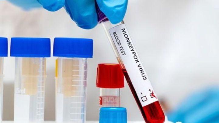 Mais de 20 pessoas estão com o vírus da ‘varíola dos macacos’ ativo em MS