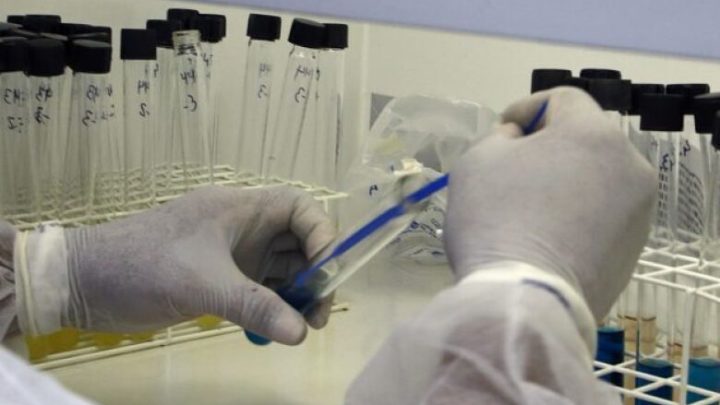 Mato Grosso do Sul tem 135 casos suspeitos de ‘varíola dos macacos’
